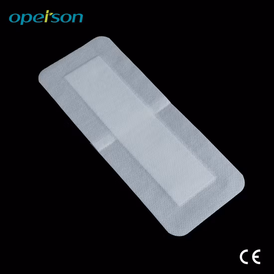 Surgical Medical Adhesive Disposable Non